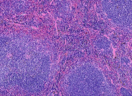 Mouse spleen HE staining