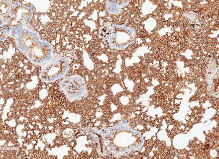 Mouse lung CD3 IHC staining